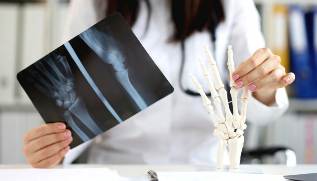 lekarz trzyma kliszę ze zdjęciem rentgenowskim dłoni, porównując ją z anatomicznym modelem szkieletu ludzkiej dłoni